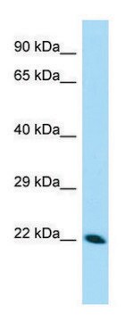 Anti-CDNF (N-terminal) antibody produced in rabbit affinity isolated antibody