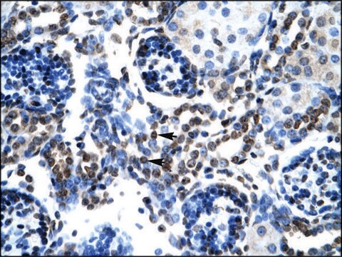 Anti-BAX IgG fraction of antiserum