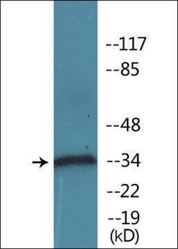 抗-磷酸化-CD32 (pTyr292) 兔抗 affinity isolated antibody