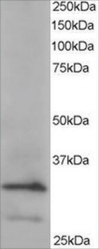 Anti-ARPC2 antibody produced in goat affinity isolated antibody, buffered aqueous solution