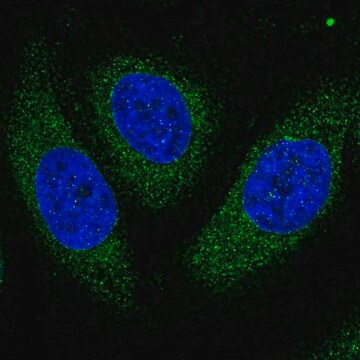 Anti-ASPH Prestige Antibodies&#174; Powered by Atlas Antibodies, affinity isolated antibody