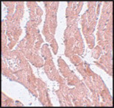 Anti-LZTR1 antibody produced in rabbit affinity isolated antibody, buffered aqueous solution