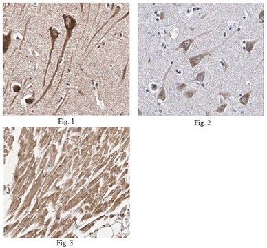 Anti-PTGDS Antibody from rabbit