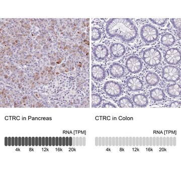 抗CTRC抗体 ウサギ宿主抗体 Prestige Antibodies&#174; Powered by Atlas Antibodies, affinity isolated antibody, buffered aqueous glycerol solution