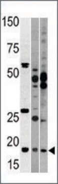 Anti-NCBP2 (N-term) antibody produced in rabbit IgG fraction of antiserum, buffered aqueous solution