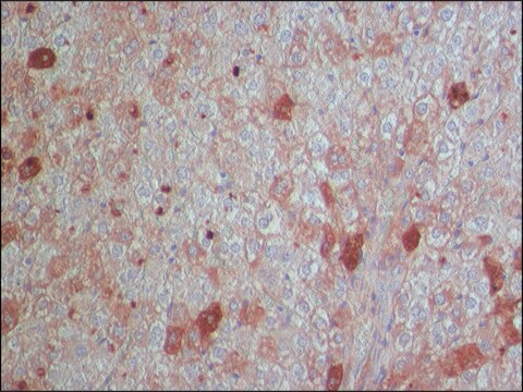 Anti-Glycogen Synthase 2 antibody produced in rabbit ~1.0&#160;mg/mL, affinity isolated antibody