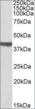 Anti-TNNT2 (C-terminal) antibody produced in goat affinity isolated antibody, buffered aqueous solution