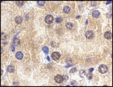 抗ST2 ウサギ宿主抗体 affinity isolated antibody, buffered aqueous solution