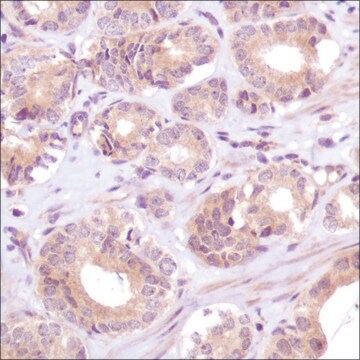 Anti-PTEN antibody, Rabbit monoclonal clone SP170, recombinant, expressed in proprietary host, affinity isolated antibody