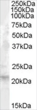 Anti-Fibroblast Growth Factor 21 antibody produced in goat affinity isolated antibody, buffered aqueous solution