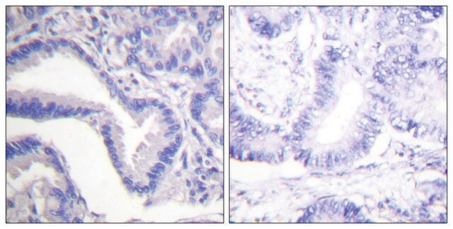 Anti-CASP7 (Cleaved-Asp198) antibody produced in rabbit affinity isolated antibody