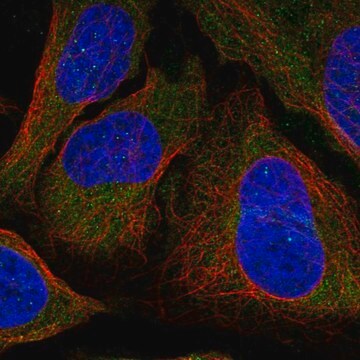 Anti-Dlc1 Antibody Produced In Rabbit Prestige Antibodies&#174; Powered by Atlas Antibodies, affinity isolated antibody, buffered aqueous glycerol solution