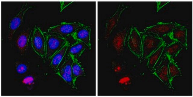 Anti-RNA polymerase II subunit B1 Antibody, clone 4F8 from rabbit, purified by affinity chromatography