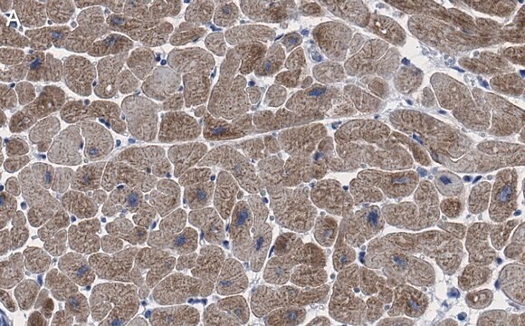 Anti-Ryanodine Receptor 2 Antibody, clone 2K6 ZooMAb&#174; Rabbit Monoclonal recombinant, expressed in HEK 293 cells