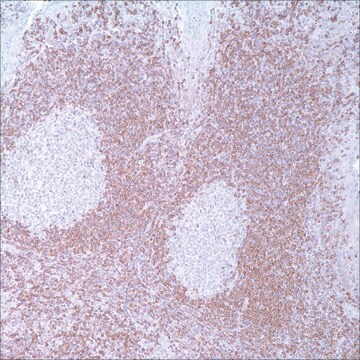 BCL2 (124) Mouse Monoclonal Antibody