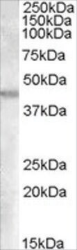 抗GOT2(アミノ酸295-306)抗体 ヤギ宿主抗体 affinity isolated antibody, buffered aqueous solution