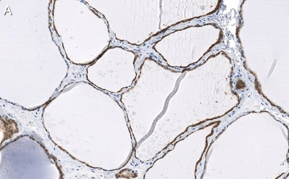 Anti-Bcl-2 Antibody, clone 1K8 ZooMAb&#174; Rabbit Monoclonal recombinant, expressed in HEK 293 cells