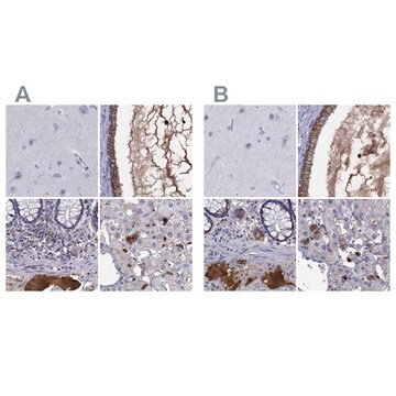 抗SERPINA3抗体 ウサギ宿主抗体 Prestige Antibodies&#174; Powered by Atlas Antibodies, affinity isolated antibody, buffered aqueous glycerol solution