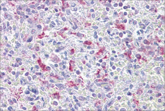 Anti-EZH1, (N-terminal) antibody produced in rabbit affinity isolated antibody