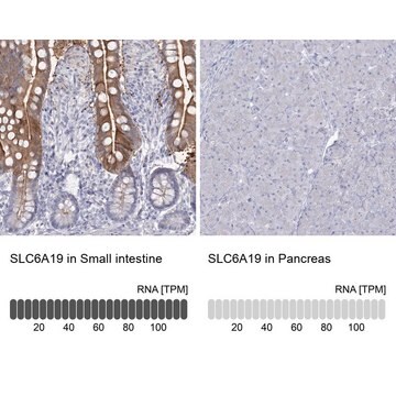 Anti-SLC6A19 antibody produced in rabbit Prestige Antibodies&#174; Powered by Atlas Antibodies, affinity isolated antibody, buffered aqueous glycerol solution