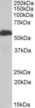 Anti-ALDH5A1 antibody produced in goat affinity isolated antibody, buffered aqueous solution