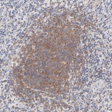 Anti-SEPT6 antibody produced in rabbit Prestige Antibodies&#174; Powered by Atlas Antibodies, affinity isolated antibody, buffered aqueous glycerol solution