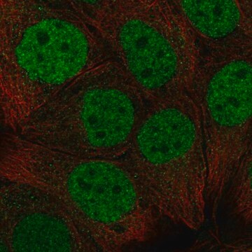 Anti-Cbx6 Antibody Produced In Rabbit Prestige Antibodies&#174; Powered by Atlas Antibodies, affinity isolated antibody, buffered aqueous glycerol solution