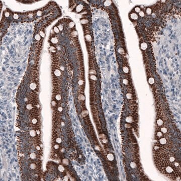 Monoclonal Anti-OTC antibody produced in mouse Prestige Antibodies&#174; Powered by Atlas Antibodies, clone CL4046, purified immunoglobulin