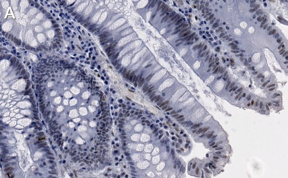 Anti-p-DNA-PKcs-Ser2056 Antibody, clone 1K3 ZooMAb&#174; Rabbit Monoclonal recombinant, expressed in HEK 293 cells