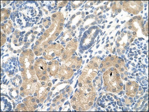 Anti-KHK antibody produced in rabbit affinity isolated antibody