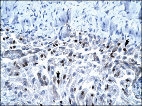 Anti-PAX7 (AB2) antibody produced in rabbit affinity isolated antibody