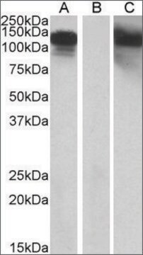 Anti-CDH11 antibody produced in goat affinity isolated antibody, buffered aqueous solution