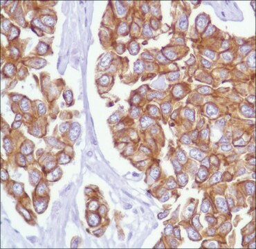 Anti-Keratin 18 antibody, Rabbit monoclonal clone SP69, recombinant, expressed in proprietary host, affinity isolated antibody