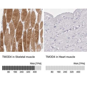 Anti-TMOD4 antibody produced in rabbit Prestige Antibodies&#174; Powered by Atlas Antibodies, affinity isolated antibody, buffered aqueous glycerol solution