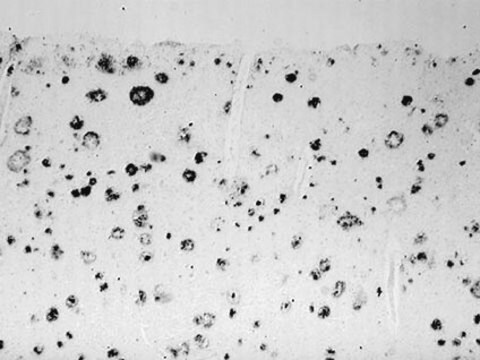 Przeciwciało anty-amyloidowe, β 37-42, aβ serum, Chemicon&#174;