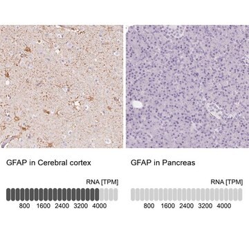 抗GFAP抗体 ウサギ宿主抗体 Prestige Antibodies&#174; Powered by Atlas Antibodies, affinity isolated antibody, buffered aqueous glycerol solution