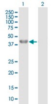 抗BHMT抗体 マウス宿主抗体 purified immunoglobulin, buffered aqueous solution