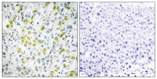 Anti-CHD4 antibody produced in rabbit affinity isolated antibody