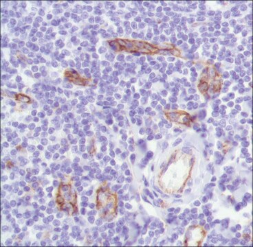 抗-CD31抗体，兔单克隆抗体 clone SP164, recombinant, expressed in proprietary host, affinity isolated antibody