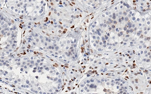 Anti-PRRX1 Antibody, clone 1L16 ZooMAb&#174; Rabbit Monoclonal recombinant, expressed in HEK 293 cells