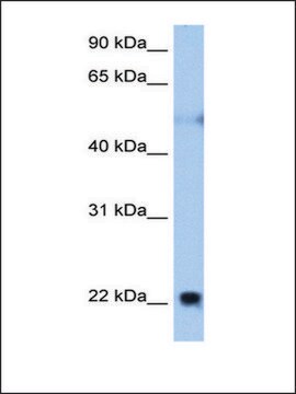 Anti-RTN4 (AB2) antibody produced in rabbit affinity isolated antibody