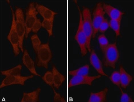 Anti-NQO1 (C-terminal) 兔抗 ~1&#160;mg/mL, affinity isolated antibody, buffered aqueous solution