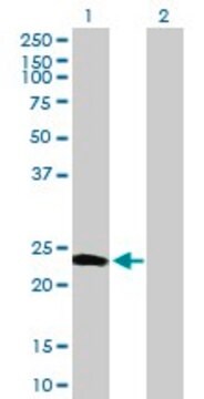 Anti-CALN1 antibody produced in mouse purified immunoglobulin, buffered aqueous solution