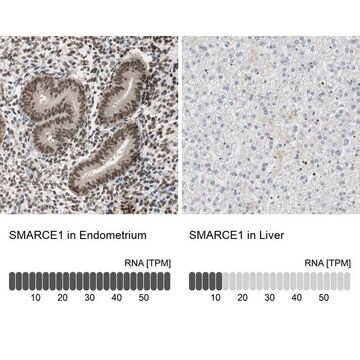 Anti-SMARCE1 antibody produced in rabbit Prestige Antibodies&#174; Powered by Atlas Antibodies, affinity isolated antibody, buffered aqueous glycerol solution