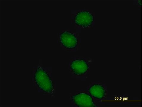 抗CBFA2T2抗体 マウス宿主抗体 IgG fraction of antiserum, buffered aqueous solution