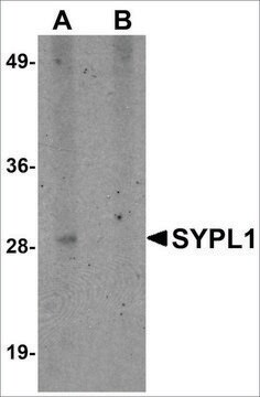 Anti-SYPL1 antibody produced in rabbit affinity isolated antibody, buffered aqueous solution