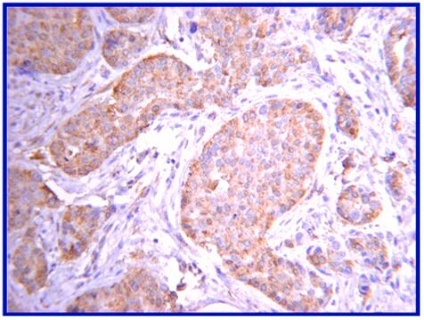 Anti-JAK2 Antibody, clone 8E10.2 clone 8E10.2, Upstate&#174;, from mouse