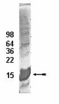 UbcH5c结合酶，100 &#181;g The His6-tagged fusion protein of UbcH5c is charge &amp; support ubiquitinylation in vitro. The His6-tagged UbcH5 family members all appear to form thiol ester conjugates with ubiquitin at a similar rate under similar conditions.