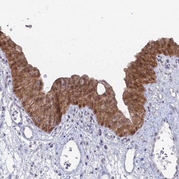 Anti-THAP4 antibody produced in rabbit Prestige Antibodies&#174; Powered by Atlas Antibodies, affinity isolated antibody, buffered aqueous glycerol solution