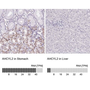 Anti-AHCYL2 antibody produced in rabbit Prestige Antibodies&#174; Powered by Atlas Antibodies, affinity isolated antibody, buffered aqueous glycerol solution